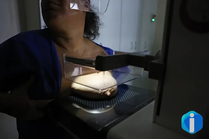 ANS defende que plano cubra mamografia digital sem restrição de idade
