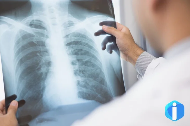 Anvisa aprova novo medicamento para câncer de pulmão avançado