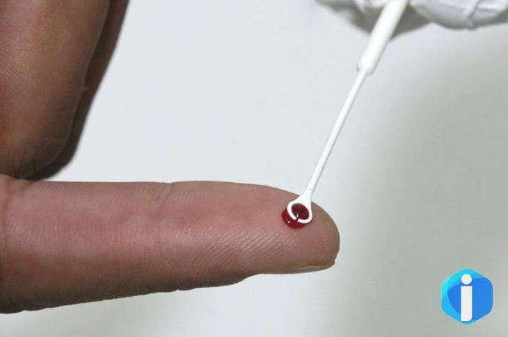 Fiji declara emergência nacional por HIV com 1 caso a cada 60 pessoas