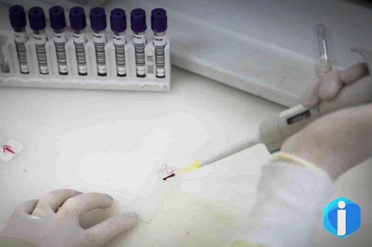 Paciente em SP com suspeita de ebola testa positivo para meningite