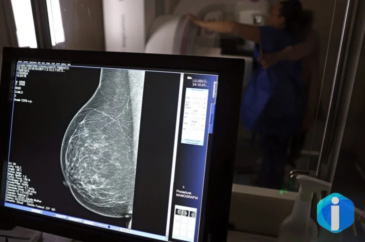 Plano de saúde terá que cobrir mamografia digital para todas as idades