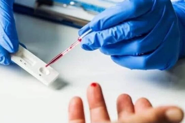 Sindicato Rural de Caiuá inicia aplicação de 3,3 mil testes gratuitos de covid-19
